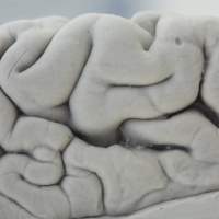 Chemical imbalance: Anyone can get depressed, but data suggest that those with major— or clinical — depression have a brain illness. The illness of depression and how psychotherapy may help