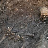 Positive identification: Forensic pathologists at the University of Leicester recently used computed tomography to match the marks on King Richard III’s skull with the blows he is supposed to have suffered from a sword and halberd in 1485. Virtual autopsy: Does it spell the end of the scalpel?