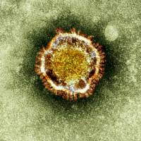 Latest threat: This electron microscope image shows a coronavirus, part of a family of viruses that cause such ailments as the common cold and SARS. Coronavirus spreads in a hospital for first time