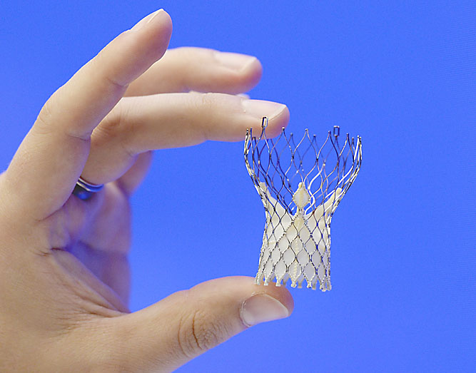 Fixing bad heart valve without surgery pushed The Japan Times