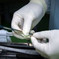 Hirotaro Iwase holds a scalpel at Chiba University on July 15. He attributes Japan's low autopsy rate to a shortage of forensic specialists. Japan's low autopsy rate may leave murders undetected