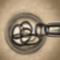 Shared science: Scientists at Riken's Center for Developmental Biology in Kobe have coaxed human embryonic stem cells into developing the cell type and structure necessary to replicate a working pituitary gland. Stem cells used to replace part of the human brain