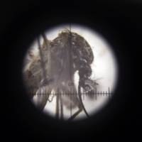 In this Tuesday photo, an Aedes aegypti mosquito is seen through a microscope at Colombia's National Institute of Health in Bogota. Margaret Honein, of the Centers for Disease Control and Prevention, said that apart from microcephaly, babies whose mothers have had Zika during pregnancy may eventually acquire impaired hearing or vision. Evidence mounts in Zika link to Guillain-Barre paralysis mainly affecting adults