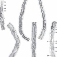 The flatworm Baracktrema obamai from a black marsh turtle and the worm's namer, Thomas Platt. Barack Obama is officially now a parasite (it's an honor)