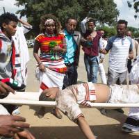 People look at a severely injured man being carried for treatment after a deadly stampede in Bishoftu, south of the Ethiopian capital of Addis Ababa, on Sunday. Dozens killed in Ethiopia stampede after police fire warning shots at protesters attending festival