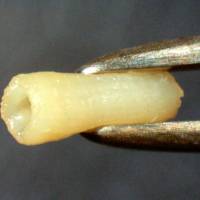 A photo shows a tube for regenerating damaged nerves, created by a group of Japanese scientists using a three-dimensional printer. Team makes nerve-regeneration breakthrough using 3-D printer