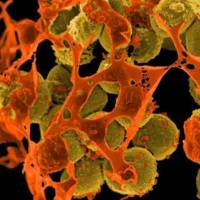 An electron microscope image shows Methicillin-resistant Staphylococcus aureus bacteria, a pathogen resistant to many antibiotics. New guidelines tackle misuse of antibiotics amid rise of superbugs