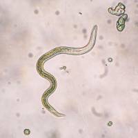 Hirotsu Bio Science and Hitachi are developing cancer tests using nematodes. Kyushu University-launched venture eyes cancer tests using worms by 2019