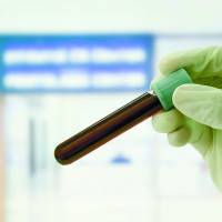 The proof-of-concept methods could lead to a “limitless supply of blood” by using cells from universal donors. Breakthrough reported in quest to make blood cells