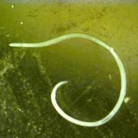 Anisakis, a parasitic worm found in many species of fish and cephlopods, can cause severe stomach pain. Anisakis infections from raw fish on rise, health ministry warns