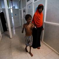 A woman walks with her son, Imran Faraj, 8, who is suffering from malnutrition at a hospital in the Red Sea port city of Hodeidah Tuesday. U.N. urges Yemen's warring sides to cease fire and open 'critical lifeline' ports to deal with cholera scourge