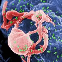 Multiple round bumps of the HIV-1 virus are seen on a cell surface in this scanning electron micrograph. South African girl is third child with HIV remission