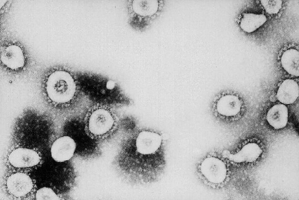 It's taken 100 scientists two years to rename airborne viruses after COVID mistakes