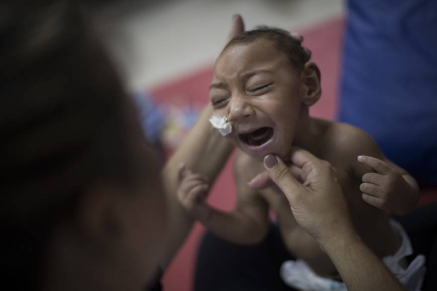 One-year-old Jose Wesley Campos, diagnosed with microcephaly linked to the Zika virus, cries at a rehabilitation center in Recife, Brazil.