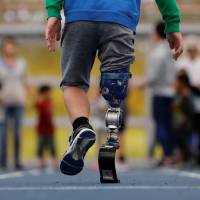 Haruta Saito\'s prosthetic blade. | REUTERS