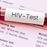 The health ministry plans offer HIV tests for free as part of annual health checks companies provide to employees to make the test more accessible. | ISTOCK