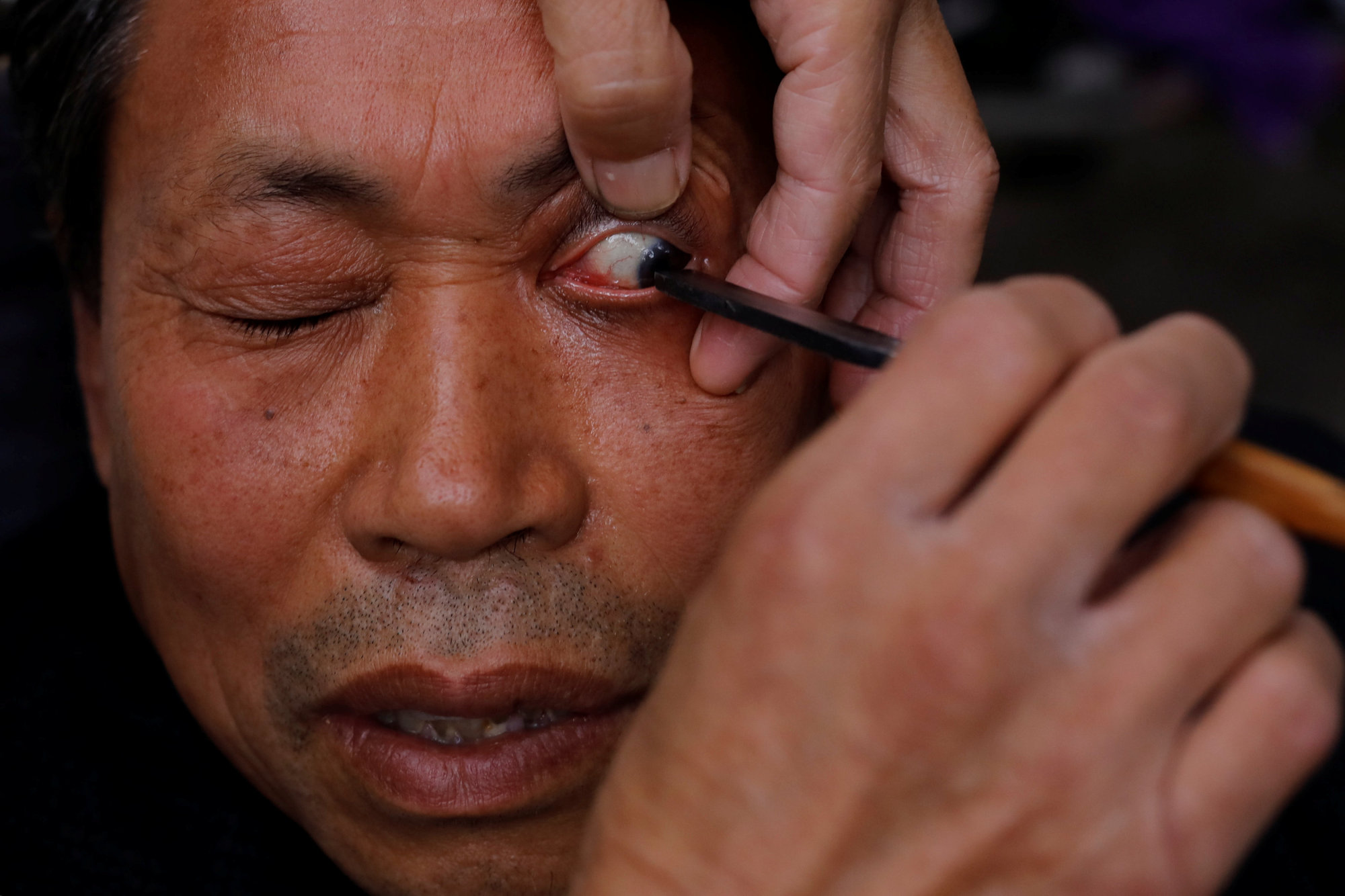 A customer looks on as Xiong Gaowu, a 62-year old street barber, cleans his eye using the straight razor in Chengdu, in southwest China's Sichuan province, on Nov. 18. | REUTERS