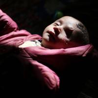 A picture taken on Dec. 4 shows Syrian baby Karim Abdallah, who lost his left eye and his mother in government shelling on the nearby town of Hammouria, in the rebel-held town of Beit Sawa, in the eastern Ghouta region on the outskirts of Damascus. | #SOLIDARITYWITHKARIM CAMPAIGN / HO / VIA AFP-JIJI