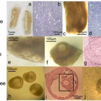 A series of magnified images show human eggs in development stages. | PROFESSOR EVELYN TELFER AND DR. MARIE MCLAUGHLIN / UNIVERSITY OF EDINBURGH / HANDOUT / VIA REUTERS