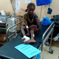 A wounded girl sits inside a hospital after a suspected Boko Haram attack on the edge of Maiduguri\'s inner city, Nigeria, Monday. | REUTERS