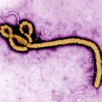 An Ebola virus is seen using an electron microscope in this image provided by the U.S. Centers for Disease Control and Prevention in Atlanta, Georgia. | CDC VIA KYODO