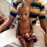 Hanaa Ahmad Ali Bahr, a malnourished girl, sits on her father\'s lap in a shanty town in Hodeidah, Yemen Monday. | REUTERS