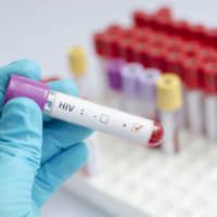 What\'s the difference between \"undetectable,\" \"long-term remission\" and \"cured\"? | GETTY IMAGES