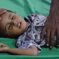 A Yemeni child receives treatment for cholera at a hospital in the Khokha district of the western province of Hodeidah on April 18. | AFP-JIJI