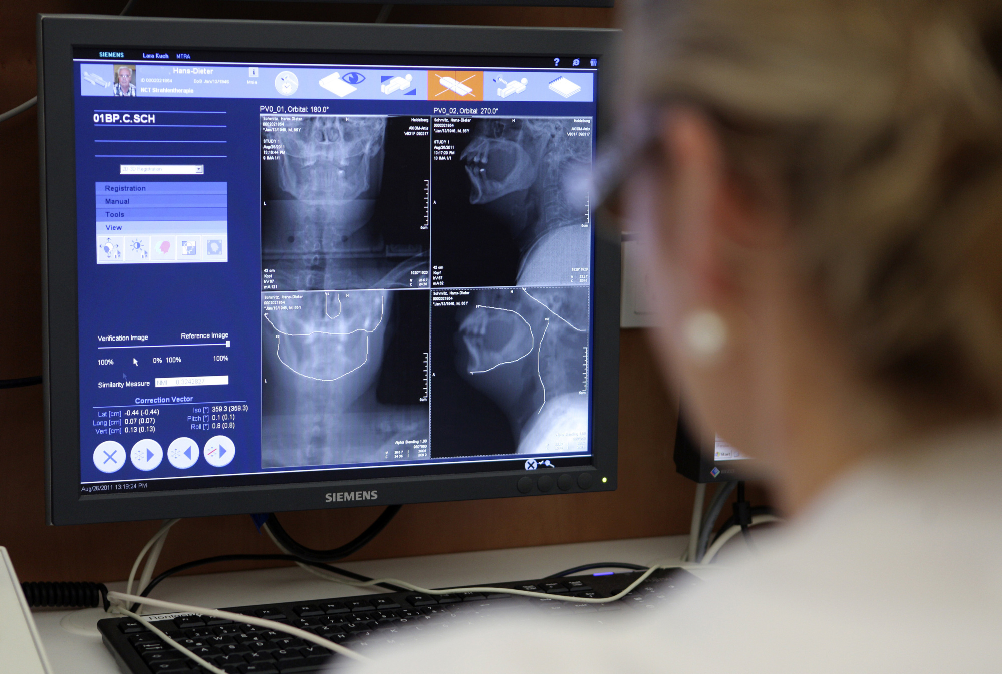 The latest research indicates that random bad luck plays a big role in the development of cancer, but early detection can still play a major role in successfully treating it. | BLOOMBERG
