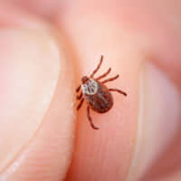 Chronic Lyme disease shows the limits of modern medicine. | GETTY IMAGES