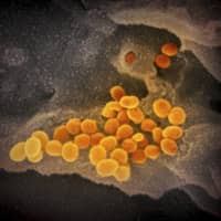 Supplied electron micrograph shows the new pneumonia-causing coronavirus. Japan will approve on Wednesday test kits that can detect novel coronavirus antigens in 15 to 30 minutes, according to sources. | U.S. NATIONAL INSTITUTE OF ALLERGY AND INFECTIOUS DISEASES / VIA KYODO