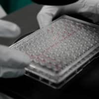 A scientist examines COVID-19 infected cells during research for a vaccine against the coronavirus at a laboratory in St. Petersburg, Russia, on May 20. | REUTERS