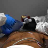 Medical workers treat a coronavirus disease patient in an intensive care unit in Houston on June 29.  | REUTERS