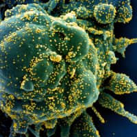 A colorized scanning electron micrograph of an apoptotic cell (green) is seen infected with the novel coronavirus. | NIH / VIA REUTERS