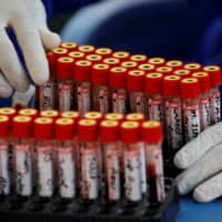 The missing ingredients in developing a COVID-19 vaccine are industrial policies and other government measures to coordinate and steer production in order to eliminate the bottlenecks that the private sector faces. | REUTERS
