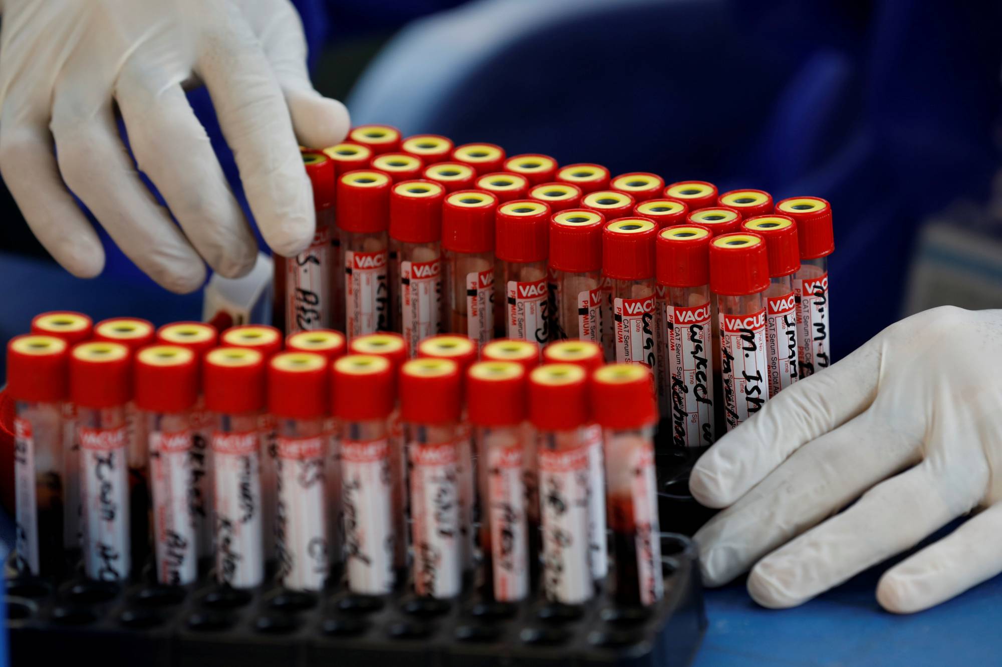 The missing ingredients in developing a COVID-19 vaccine are industrial policies and other government measures to coordinate and steer production in order to eliminate the bottlenecks that the private sector faces. | REUTERS