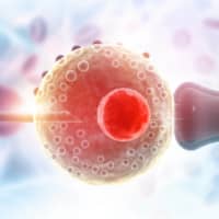 In vitro fertilization, which is considered the most effective form of assisted reproductive technology, is currently not covered by the national health care program. | GETTY IMAGES