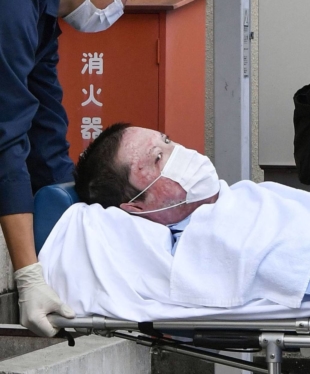 Shinji Aoba lies on a stretcher as he is brought into Fushimi Police Station in Kyoto in May after being arrested. | KYODO