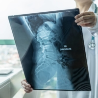 Many opinions: While being diagnosed with an illness can be terrifying in a country where you don\'t speak the language, Japan has some of the best health care facilities in the world.  | GETTY IMAGES