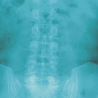 X marks the spot: An x-ray shows a patient\'s pelvic region.  | GETTY IMAGES