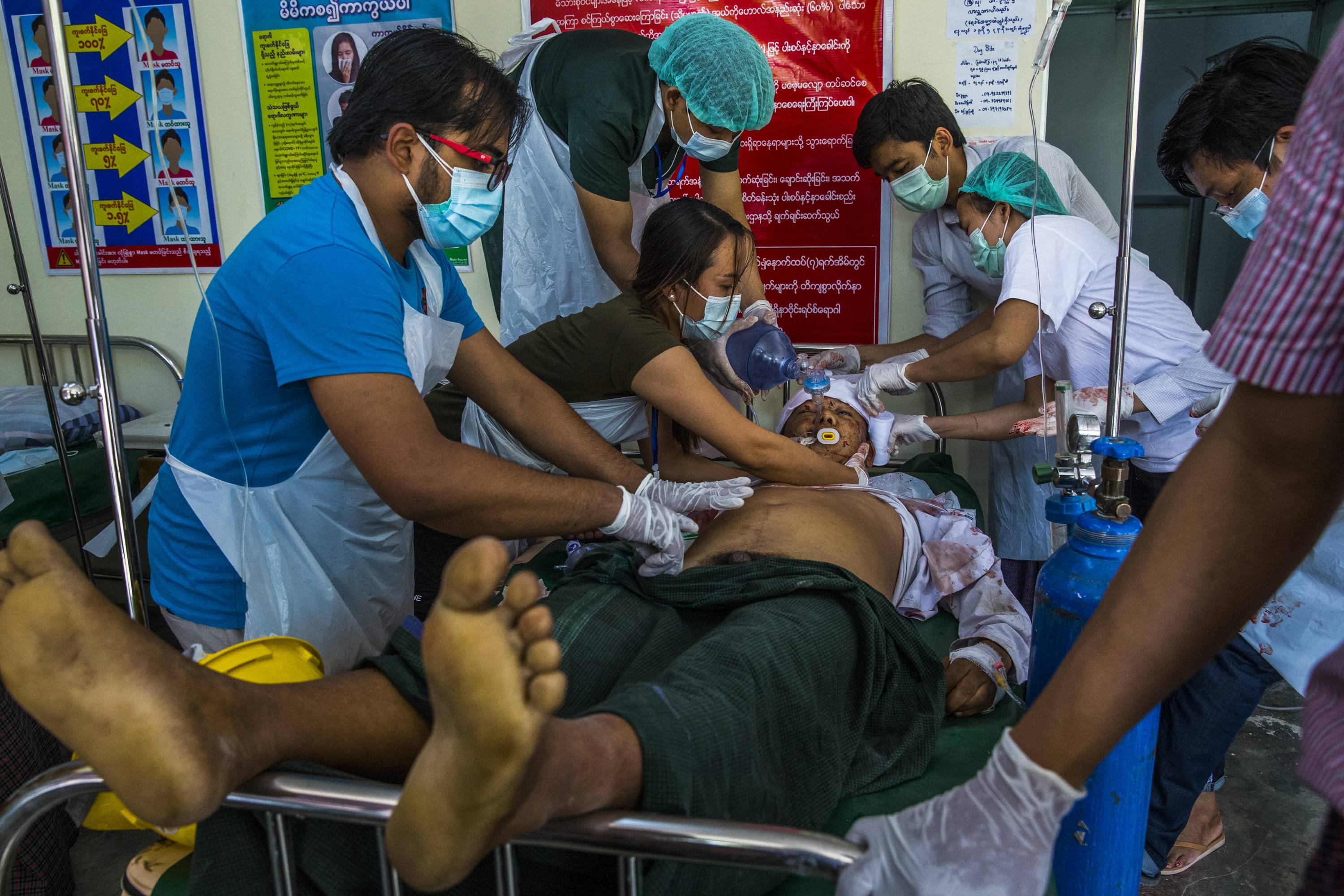 A man receives medical attention after being shot in the head by security forces in Mandalay, Myanmar, on Sunday. After four weeks of protests, the military in Myanmar opened fire on demonstrators in several cities on Sunday, killing at least 18 people, the United Nations said, in the most vicious effort yet to extinguish the unrest roiling the nation. | The New York Times