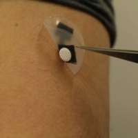 The patch uses low-voltage electricity, allowing an array of porous microneedles on the patch to administer more of the drug into the skin, and faster. | MATSUHIKO NISHIZAWA
