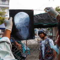 An X-ray of the head of Shel Ye Win, who was shot in the face with a live round during a crackdown by security forces on demonstrations by protesters against the military coup, is shown in Mandalay, Myanmar, on Sunday. | AFP-JIJI