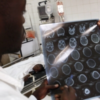 The world has the capability to extend high-quality assessment technology to nations in need. In Rwanda, for instance, there’s only one radiologist for every million people. | REUTERS