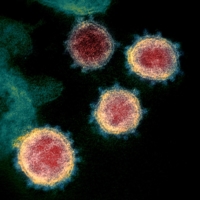 Dr. Shi Zhengli published some of the most important early papers on SARS-CoV-2 and COVID-19, which scientists around the world have relied on. | NIAID-RML / VIA REUTERS