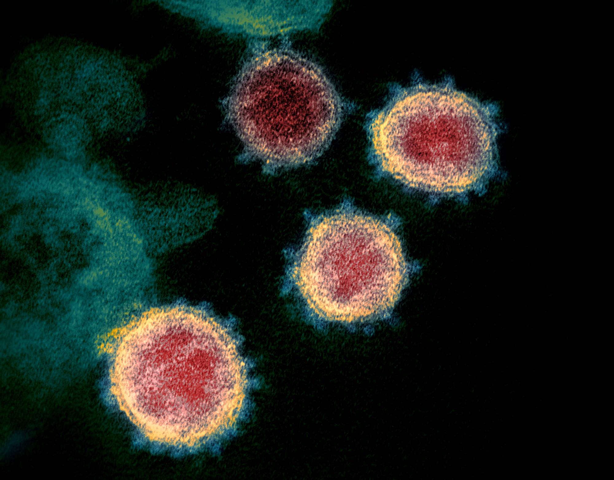 Dr. Shi Zhengli published some of the most important early papers on SARS-CoV-2 and COVID-19, which scientists around the world have relied on. | NIAID-RML / via REUTERS