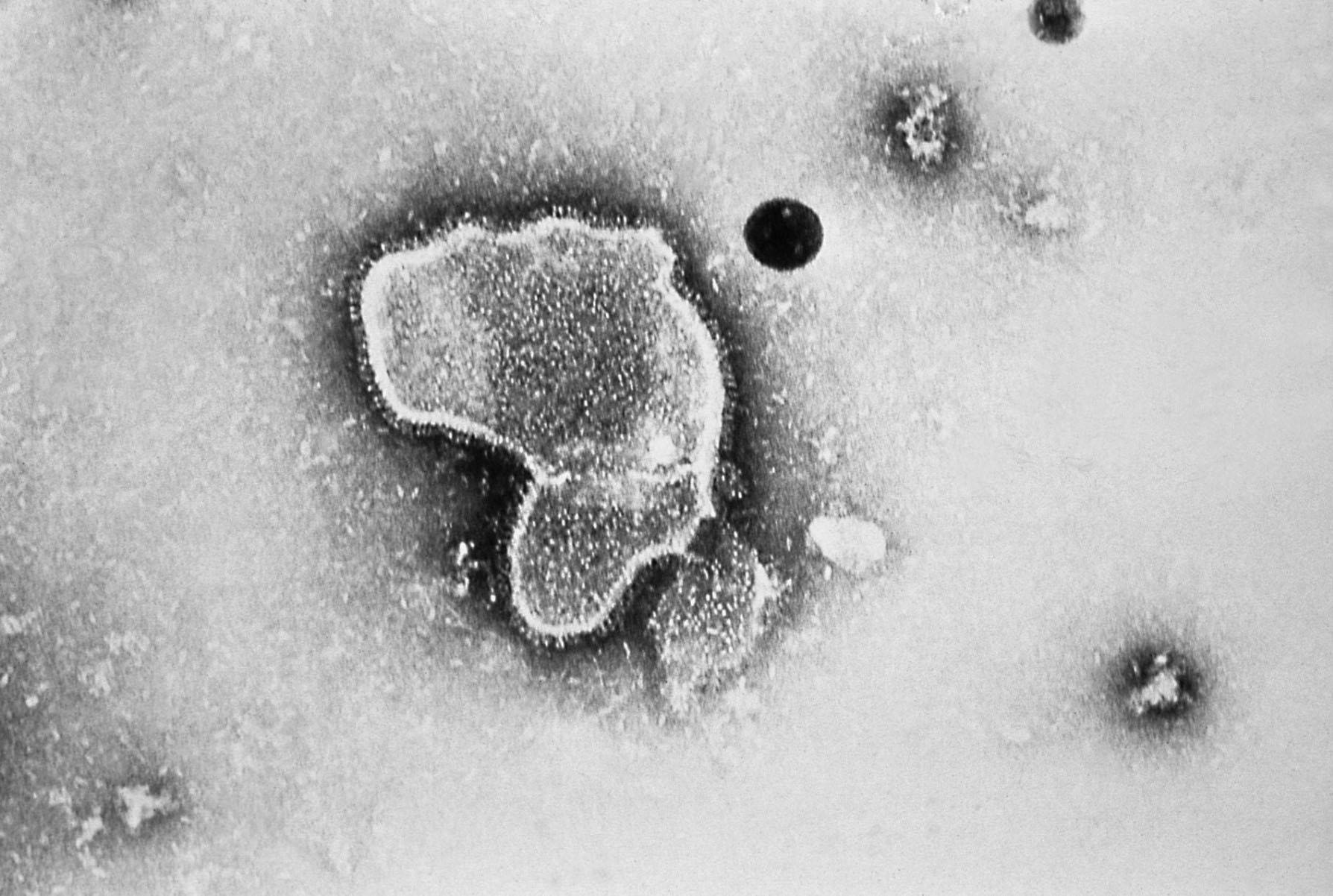 The respiratory syncytial virus mainly spreads via respiratory droplets when a person coughs or sneezes, as well as through direct contact with a contaminated surface — somewhat similar transmission routes to the coronavirus. | CENTERS FOR DISEASE CONTROL AND PREVENTION/VIA KYODO