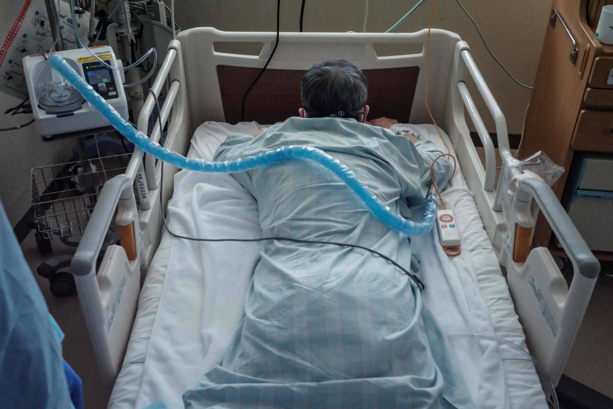 A COVID-19 patient lies on a bed at Hokkaido University Hospital in Sapporo on Tuesday. | AFP-JIJI