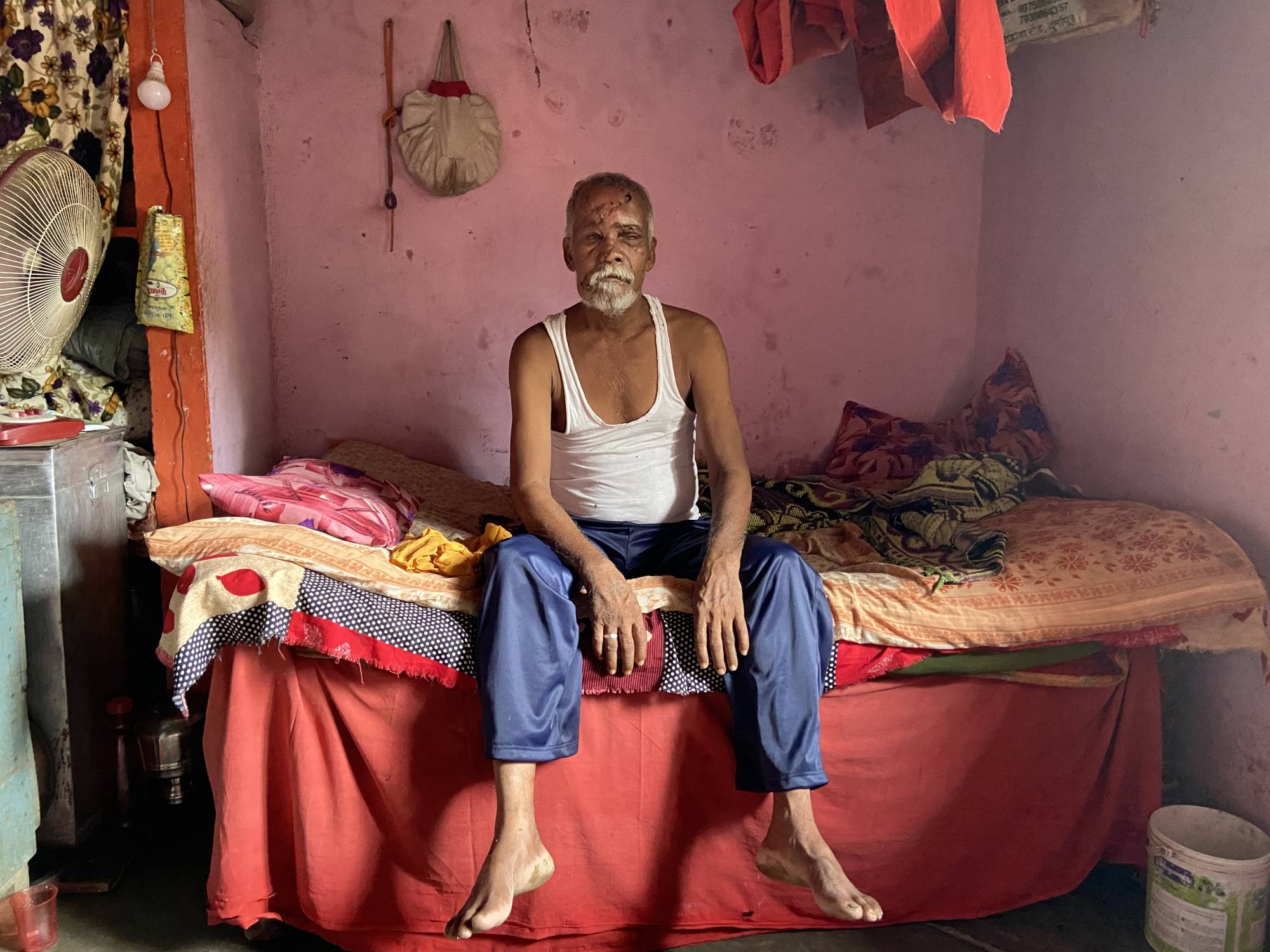 Bear attack victim Suresh Shankar Khiradkar at home in Payali Bhatali village in Chandrapur | THOMSON REUTERS FOUNDATION