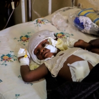 Dawud Ali, 8, sleeps in a bed at Dubti Referral Hospital, in Dubti town, Afar region, Ethiopia, on Feb. 24. | REUTERS
